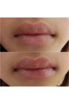 Lucas Papaw Ointment